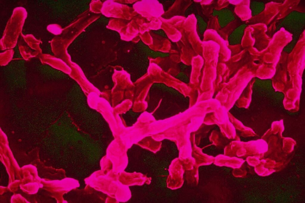 Microscopic image of bacteria associated with typhoid fever